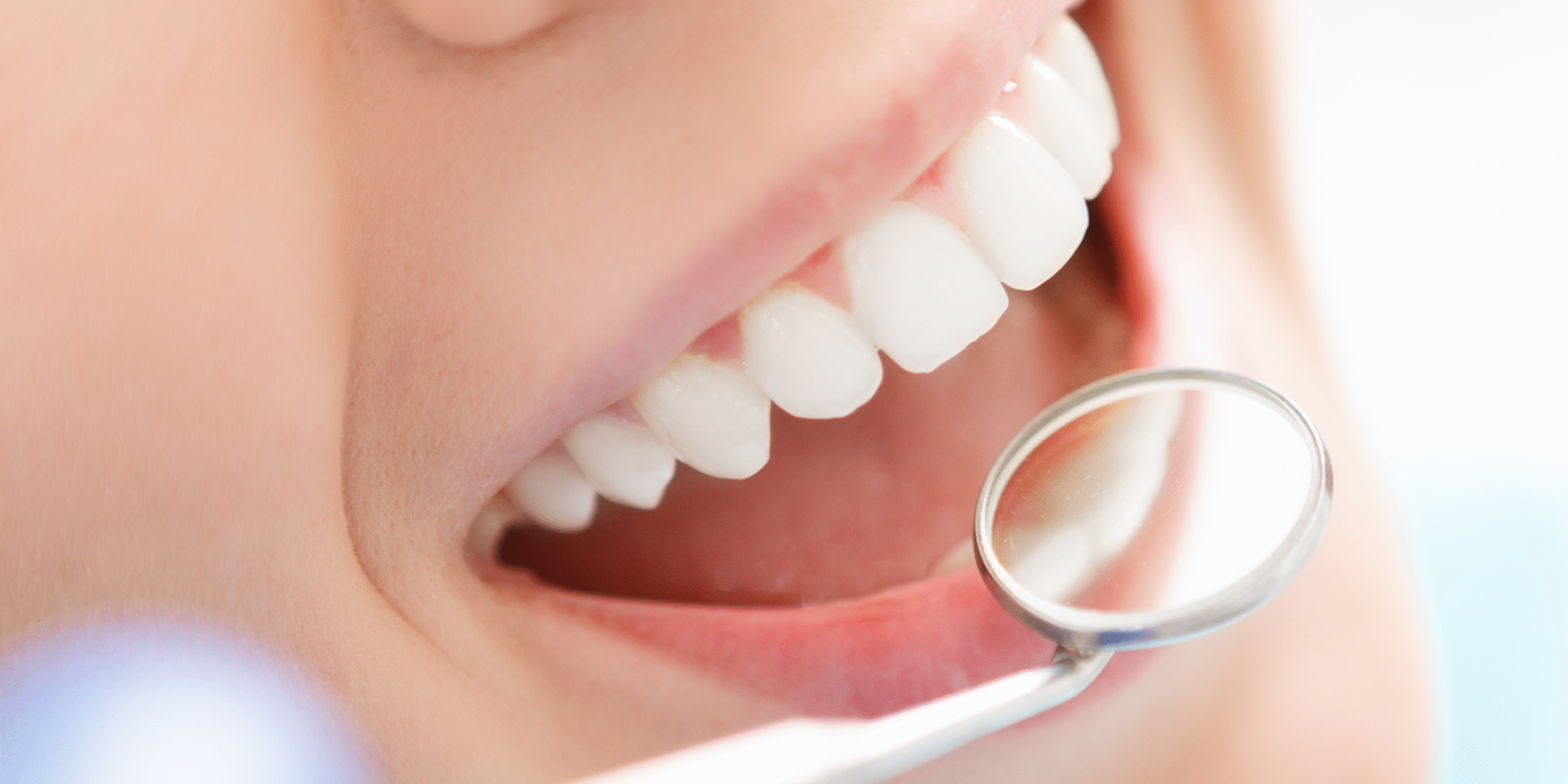Why Dental Implants Are a Lifelong Solution for Lasting Oral Health
